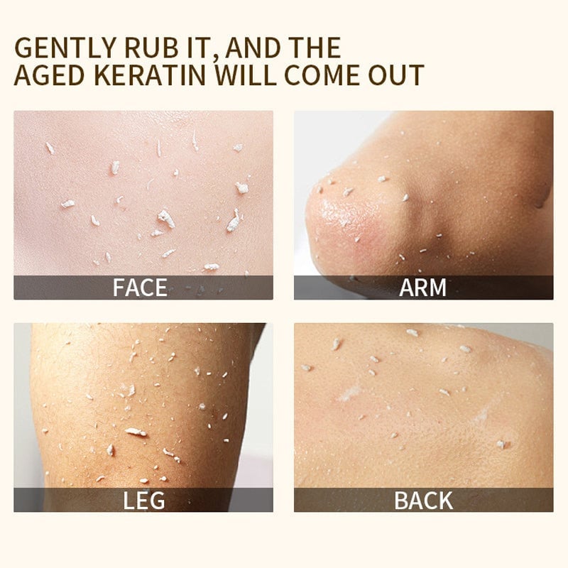 🔥 Hot Sale 49% OFF🎁Orange Enzyme Exfoliating Gel 50g – Facial Cleansing Peel